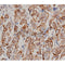 DF6087 staining HepG2 by IF/ICC. The sample were fixed with PFA and permeabilized in 0.1% Triton X-100,then blocked in 10% serum for 45 minutes at 25¡ãC. The primary antibody was diluted at 1/200 and incubated with the sample for 1 hour at 37¡ãC. An  Alexa Fluor 594 conjugated goat anti-rabbit IgG (H+L) Ab, diluted at 1/600, was used as the secondary antibod