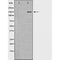 Western blot analysis of extracts of liver , using INSR antibody. The lane on the left is treated with the antigen-specific peptide.