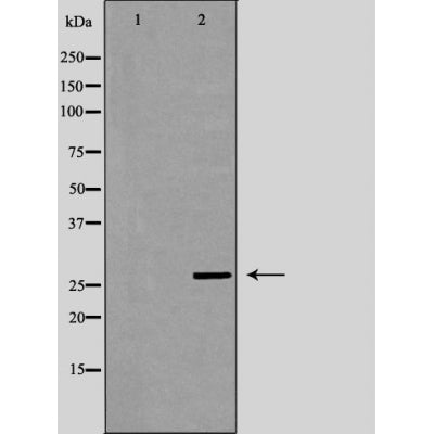 DF6090 at 1/100 staining Mouse liver tissue by IHC-P. The sample was formaldehyde fixed and a heat mediated antigen retrieval step in citrate buffer was performed. The sample was then blocked and incubated with the antibody for 1.5 hours at 22¡ãC. An HRP conjugated goat anti-rabbit antibody was used as the secondary
