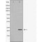 Western blot analysis of extracts of mouse eye tissue, using BIM antibody. The lane on the left is treated with the antigen-specific peptide.
