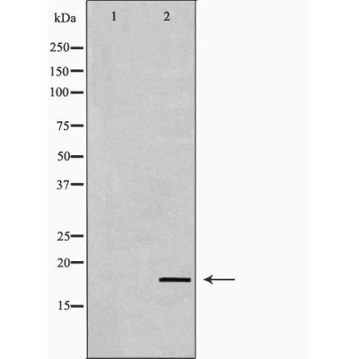 DF6095 staining HepG2 by IF/ICC. The sample were fixed with PFA and permeabilized in 0.1% Triton X-100,then blocked in 10% serum for 45 minutes at 25¡ãC. The primary antibody was diluted at 1/200 and incubated with the sample for 1 hour at 37¡ãC. An  Alexa Fluor 594 conjugated goat anti-rabbit IgG (H+L) Ab, diluted at 1/600, was used as the secondary antibod