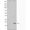 DF6095 staining HepG2 by IF/ICC. The sample were fixed with PFA and permeabilized in 0.1% Triton X-100,then blocked in 10% serum for 45 minutes at 25¡ãC. The primary antibody was diluted at 1/200 and incubated with the sample for 1 hour at 37¡ãC. An  Alexa Fluor 594 conjugated goat anti-rabbit IgG (H+L) Ab, diluted at 1/600, was used as the secondary antibod