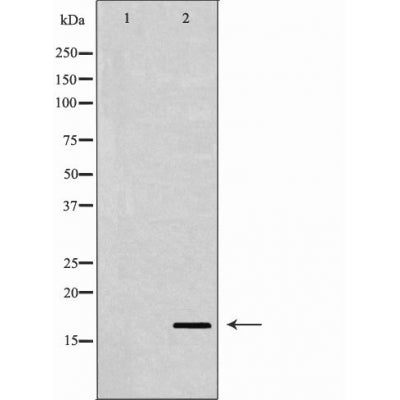 DF6096 at 1/100 staining Human uterus tissue by IHC-P. The sample was formaldehyde fixed and a heat mediated antigen retrieval step in citrate buffer was performed. The sample was then blocked and incubated with the antibody for 1.5 hours at 22¡ãC. An HRP conjugated goat anti-rabbit antibody was used as the secondary