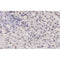 AF0123 at 1/200 staining human liver carcinoma tissue sections by IHC-P. The tissue was formaldehyde fixed and a heat mediated antigen retrieval step in citrate buffer was performed. The tissue was then blocked and incubated with the antibody for 1.5 hours at 22¡ãC. An HRP conjugated goat anti-rabbit antibody was used as the secondary