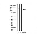 Western blot analysis of extracts from 293, using CARD6 Antibody.