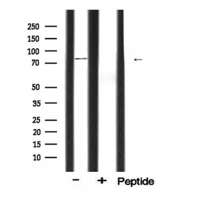 DF6100 staining COS7 by IF/ICC. The sample were fixed with PFA and permeabilized in 0.1% Triton X-100,then blocked in 10% serum for 45 minutes at 25¡ãC. The primary antibody was diluted at 1/200 and incubated with the sample for 1 hour at 37¡ãC. An  Alexa Fluor 594 conjugated goat anti-rabbit IgG (H+L) Ab, diluted at 1/600, was used as the secondary antibod