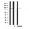 DF6100 staining COS7 by IF/ICC. The sample were fixed with PFA and permeabilized in 0.1% Triton X-100,then blocked in 10% serum for 45 minutes at 25¡ãC. The primary antibody was diluted at 1/200 and incubated with the sample for 1 hour at 37¡ãC. An  Alexa Fluor 594 conjugated goat anti-rabbit IgG (H+L) Ab, diluted at 1/600, was used as the secondary antibod