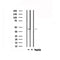 DF6103 at 1/100 staining Mouse brain tissue by IHC-P. The sample was formaldehyde fixed and a heat mediated antigen retrieval step in citrate buffer was performed. The sample was then blocked and incubated with the antibody for 1.5 hours at 22¡ãC. An HRP conjugated goat anti-rabbit antibody was used as the secondary