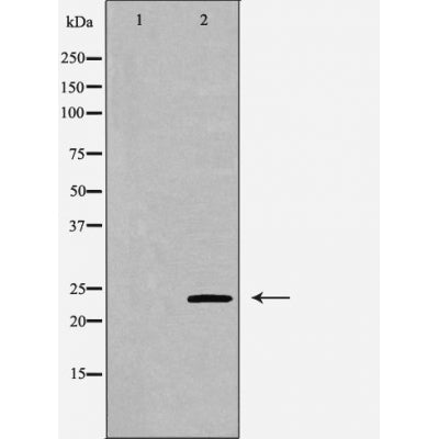 DF6104 at 1/100 staining Mouse kidney tissue by IHC-P. The sample was formaldehyde fixed and a heat mediated antigen retrieval step in citrate buffer was performed. The sample was then blocked and incubated with the antibody for 1.5 hours at 22¡ãC. An HRP conjugated goat anti-rabbit antibody was used as the secondary