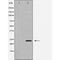 DF6104 at 1/100 staining Mouse kidney tissue by IHC-P. The sample was formaldehyde fixed and a heat mediated antigen retrieval step in citrate buffer was performed. The sample was then blocked and incubated with the antibody for 1.5 hours at 22¡ãC. An HRP conjugated goat anti-rabbit antibody was used as the secondary