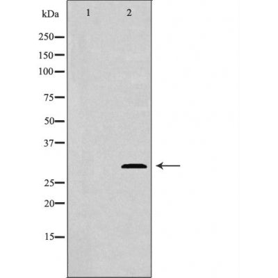 DF6105 at 1/100 staining Mouse brain tissue by IHC-P. The sample was formaldehyde fixed and a heat mediated antigen retrieval step in citrate buffer was performed. The sample was then blocked and incubated with the antibody for 1.5 hours at 22¡ãC. An HRP conjugated goat anti-rabbit antibody was used as the secondary