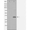 DF6109 at 1/100 staining Mouse brain tissue by IHC-P. The sample was formaldehyde fixed and a heat mediated antigen retrieval step in citrate buffer was performed. The sample was then blocked and incubated with the antibody for 1.5 hours at 22¡ãC. An HRP conjugated goat anti-rabbit antibody was used as the secondary