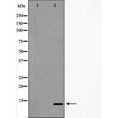 DF6112 at 1/100 staining Rat brain tissue by IHC-P. The sample was formaldehyde fixed and a heat mediated antigen retrieval step in citrate buffer was performed. The sample was then blocked and incubated with the antibody for 1.5 hours at 22¡ãC. An HRP conjugated goat anti-rabbit antibody was used as the secondary