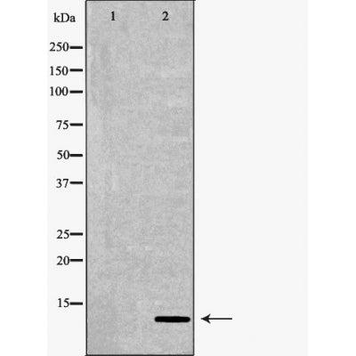 DF6116 at 1/100 staining Mouse kidney tissue by IHC-P. The sample was formaldehyde fixed and a heat mediated antigen retrieval step in citrate buffer was performed. The sample was then blocked and incubated with the antibody for 1.5 hours at 22¡ãC. An HRP conjugated goat anti-rabbit antibody was used as the secondary