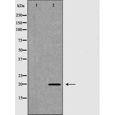 Western blot analysis of 293  lysate using FAIM antibody. The lane on the left is treated with the antigen-specific peptide.