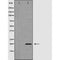 Western blot analysis of 293  lysate using FAIM antibody. The lane on the left is treated with the antigen-specific peptide.