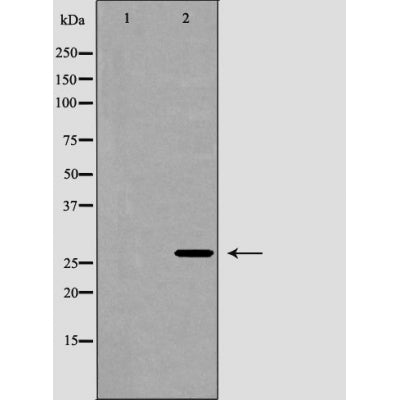 DF6121 at 1/100 staining Mouse pancreas tissue by IHC-P. The sample was formaldehyde fixed and a heat mediated antigen retrieval step in citrate buffer was performed. The sample was then blocked and incubated with the antibody for 1.5 hours at 22¡ãC. An HRP conjugated goat anti-rabbit antibody was used as the secondary