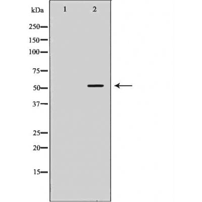DF6122 at 1/100 staining Mouse liver tissue by IHC-P. The sample was formaldehyde fixed and a heat mediated antigen retrieval step in citrate buffer was performed. The sample was then blocked and incubated with the antibody for 1.5 hours at 22¡ãC. An HRP conjugated goat anti-rabbit antibody was used as the secondary