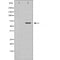 DF6123 at 1/100 staining Human brain tissue by IHC-P. The sample was formaldehyde fixed and a heat mediated antigen retrieval step in citrate buffer was performed. The sample was then blocked and incubated with the antibody for 1.5 hours at 22¡ãC. An HRP conjugated goat anti-rabbit antibody was used as the secondary