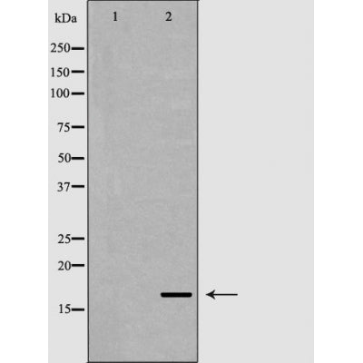 Western blot analysis of 293T  lysate using FGF1 antibody. The lane on the left is treated with the antigen-specific peptide.