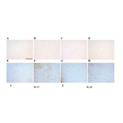 DF6127 staining HepG2 by IF/ICC. The sample were fixed with PFA and permeabilized in 0.1% Triton X-100,then blocked in 10% serum for 45 minutes at 25¡ãC. The primary antibody was diluted at 1/200 and incubated with the sample for 1 hour at 37¡ãC. An  Alexa Fluor 594 conjugated goat anti-rabbit IgG (H+L) Ab, diluted at 1/600, was used as the secondary antibod