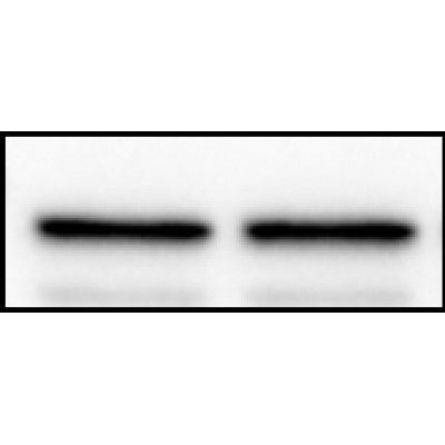 DF6130 at 1/100 staining Human lymph node tissue by IHC-P. The sample was formaldehyde fixed and a heat mediated antigen retrieval step in citrate buffer was performed. The sample was then blocked and incubated with the antibody for 1.5 hours at 22¡ãC. An HRP conjugated goat anti-rabbit antibody was used as the secondary
