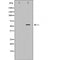 Western blot analysis of Mouse liver tissue lysates, using P4HB Antibody. The lane on the left is treated with the antigen-specific peptide.