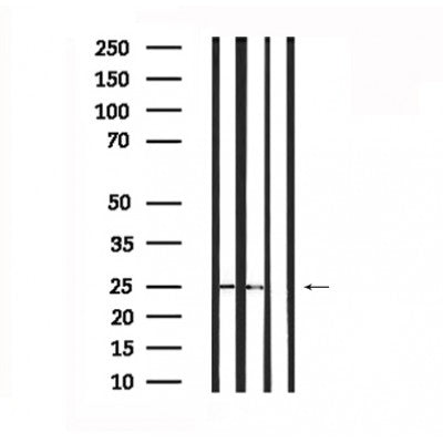 DF6133 at 1/100 staining Mouse muscle tissue by IHC-P. The sample was formaldehyde fixed and a heat mediated antigen retrieval step in citrate buffer was performed. The sample was then blocked and incubated with the antibody for 1.5 hours at 22¡ãC. An HRP conjugated goat anti-rabbit antibody was used as the secondary