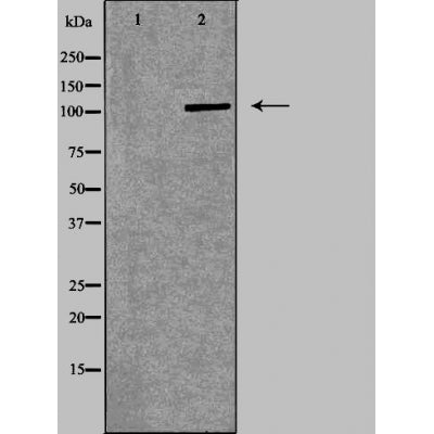 DF6135 at 1/100 staining Human pancreas tissue by IHC-P. The sample was formaldehyde fixed and a heat mediated antigen retrieval step in citrate buffer was performed. The sample was then blocked and incubated with the antibody for 1.5 hours at 22¡ãC. An HRP conjugated goat anti-rabbit antibody was used as the secondary