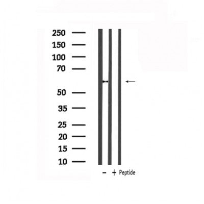 DF6137 at 1/100 staining Human uterus tissue by IHC-P. The sample was formaldehyde fixed and a heat mediated antigen retrieval step in citrate buffer was performed. The sample was then blocked and incubated with the antibody for 1.5 hours at 22¡ãC. An HRP conjugated goat anti-rabbit antibody was used as the secondary