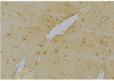 Western blot analysis of extracts from Mouse  kidney, using NeuN Antibody. The lane on the left was treated with blocking peptide.