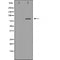 DF6147 at 1/100 staining Human prostate tissue by IHC-P. The sample was formaldehyde fixed and a heat mediated antigen retrieval step in citrate buffer was performed. The sample was then blocked and incubated with the antibody for 1.5 hours at 22¡ãC. An HRP conjugated goat anti-rabbit antibody was used as the secondary