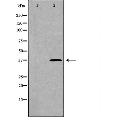 DF6149 at 1/100 staining Human lymph node tissue by IHC-P. The sample was formaldehyde fixed and a heat mediated antigen retrieval step in citrate buffer was performed. The sample was then blocked and incubated with the antibody for 1.5 hours at 22¡ãC. An HRP conjugated goat anti-rabbit antibody was used as the secondary