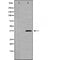 DF6149 at 1/100 staining Human lymph node tissue by IHC-P. The sample was formaldehyde fixed and a heat mediated antigen retrieval step in citrate buffer was performed. The sample was then blocked and incubated with the antibody for 1.5 hours at 22¡ãC. An HRP conjugated goat anti-rabbit antibody was used as the secondary