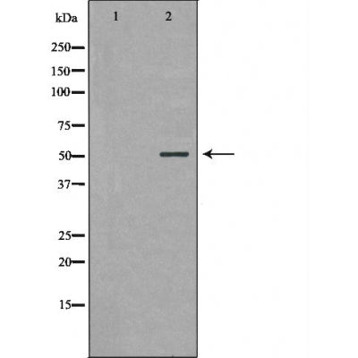 DF6150 at 1/100 staining Rat liver tissue by IHC-P. The sample was formaldehyde fixed and a heat mediated antigen retrieval step in citrate buffer was performed. The sample was then blocked and incubated with the antibody for 1.5 hours at 22¡ãC. An HRP conjugated goat anti-rabbit antibody was used as the secondary