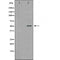 DF6150 at 1/100 staining Rat liver tissue by IHC-P. The sample was formaldehyde fixed and a heat mediated antigen retrieval step in citrate buffer was performed. The sample was then blocked and incubated with the antibody for 1.5 hours at 22¡ãC. An HRP conjugated goat anti-rabbit antibody was used as the secondary