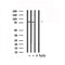 DF6152 at 1/100 staining Human liver cancer tissue by IHC-P. The sample was formaldehyde fixed and a heat mediated antigen retrieval step in citrate buffer was performed. The sample was then blocked and incubated with the antibody for 1.5 hours at 22¡ãC. An HRP conjugated goat anti-rabbit antibody was used as the secondary