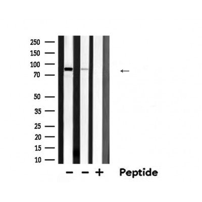 DF6154 staining LOVO by IF/ICC. The sample were fixed with PFA and permeabilized in 0.1% Triton X-100,then blocked in 10% serum for 45 minutes at 25¡ãC. The primary antibody was diluted at 1/200 and incubated with the sample for 1 hour at 37¡ãC. An  Alexa Fluor 594 conjugated goat anti-rabbit IgG (H+L) Ab, diluted at 1/600, was used as the secondary antibod