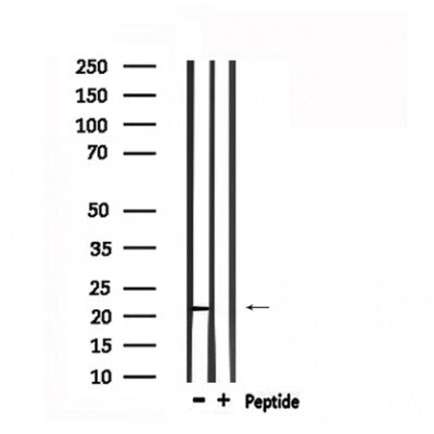 DF6157 at 1/100 staining Mouse lung tissue by IHC-P. The sample was formaldehyde fixed and a heat mediated antigen retrieval step in citrate buffer was performed. The sample was then blocked and incubated with the antibody for 1.5 hours at 22¡ãC. An HRP conjugated goat anti-rabbit antibody was used as the secondary