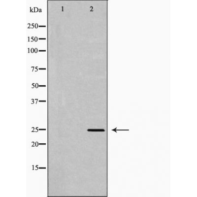 DF6158 at 1/100 staining Rat lung tissue by IHC-P. The sample was formaldehyde fixed and a heat mediated antigen retrieval step in citrate buffer was performed. The sample was then blocked and incubated with the antibody for 1.5 hours at 22¡ãC. An HRP conjugated goat anti-rabbit antibody was used as the secondary
