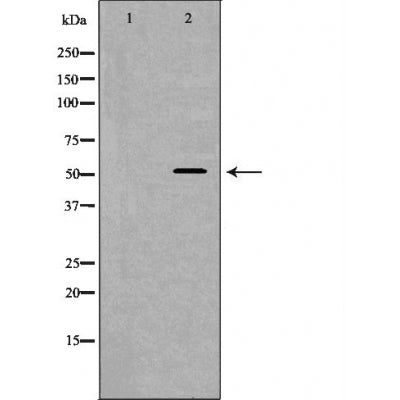 DF6160 at 1/100 staining Mouse testis tissue by IHC-P. The sample was formaldehyde fixed and a heat mediated antigen retrieval step in citrate buffer was performed. The sample was then blocked and incubated with the antibody for 1.5 hours at 22¡ãC. An HRP conjugated goat anti-rabbit antibody was used as the secondary