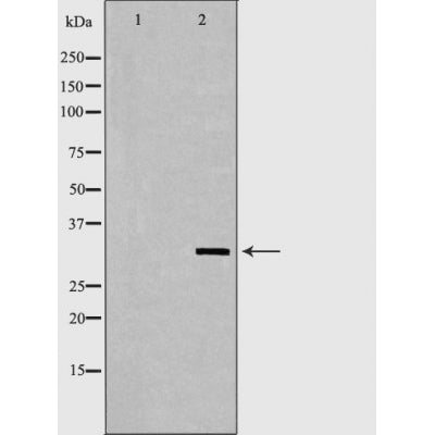 DF6162 at 1/100 staining Mouse lung tissue by IHC-P. The sample was formaldehyde fixed and a heat mediated antigen retrieval step in citrate buffer was performed. The sample was then blocked and incubated with the antibody for 1.5 hours at 22¡ãC. An HRP conjugated goat anti-rabbit antibody was used as the secondary