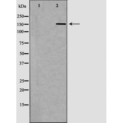 DF6165 at 1/100 staining Mouse brain tissue by IHC-P. The sample was formaldehyde fixed and a heat mediated antigen retrieval step in citrate buffer was performed. The sample was then blocked and incubated with the antibody for 1.5 hours at 22¡ãC. An HRP conjugated goat anti-rabbit antibody was used as the secondary