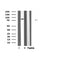 DF6171 at 1/100 staining Mouse lung tissue by IHC-P. The sample was formaldehyde fixed and a heat mediated antigen retrieval step in citrate buffer was performed. The sample was then blocked and incubated with the antibody for 1.5 hours at 22¡ãC. An HRP conjugated goat anti-rabbit antibody was used as the secondary