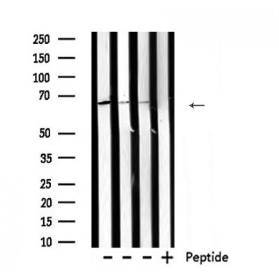DF6172 at 1/100 staining Mouse brain tissue by IHC-P. The sample was formaldehyde fixed and a heat mediated antigen retrieval step in citrate buffer was performed. The sample was then blocked and incubated with the antibody for 1.5 hours at 22¡ãC. An HRP conjugated goat anti-rabbit antibody was used as the secondary