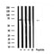 DF6172 at 1/100 staining Mouse brain tissue by IHC-P. The sample was formaldehyde fixed and a heat mediated antigen retrieval step in citrate buffer was performed. The sample was then blocked and incubated with the antibody for 1.5 hours at 22¡ãC. An HRP conjugated goat anti-rabbit antibody was used as the secondary