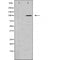 DF6176 at 1/100 staining Mouse muscle tissue by IHC-P. The sample was formaldehyde fixed and a heat mediated antigen retrieval step in citrate buffer was performed. The sample was then blocked and incubated with the antibody for 1.5 hours at 22¡ãC. An HRP conjugated goat anti-rabbit antibody was used as the secondary