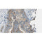 Western blot analysis of extracts from 293t, using TPMT  Antibody. The lane on the left was treated with blocking peptide.

Observed bands: 35 kDa.