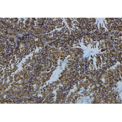 Western blot analysis of extracts from 293t, using ADA Antibody. The lane on the left was treated with blocking peptide.