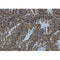 Western blot analysis of extracts from 293t, using ADA Antibody. The lane on the left was treated with blocking peptide.